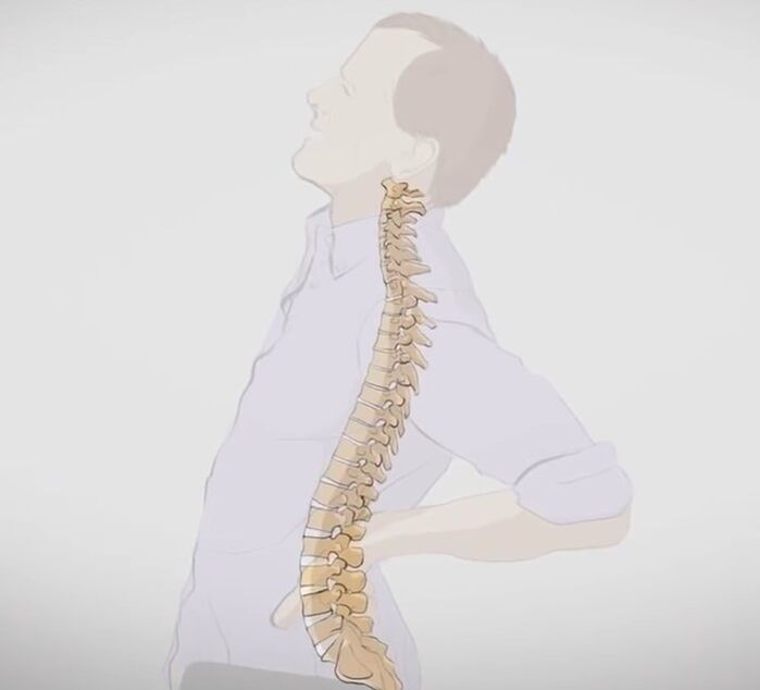 Rückenschmerzen im Lendenwirbelbereich