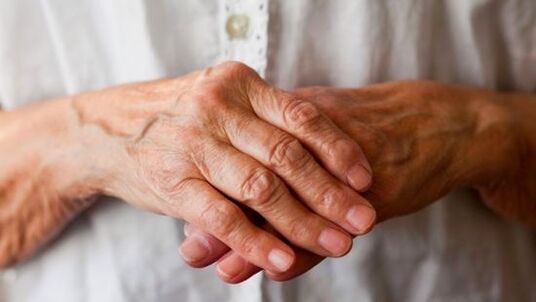 rheumatoide Arthritis als Ursache von Schmerzen in den Fingergelenken