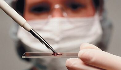 Differentialdiagnose von Attribut und Arthrose